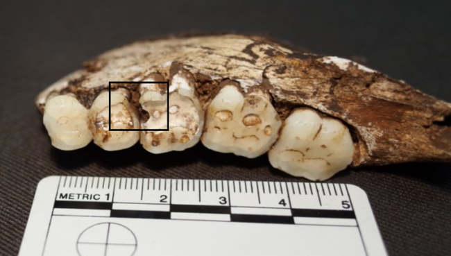 Фото - Сахар ни при чем: у наших древних предков были такие же проблемы с зубами