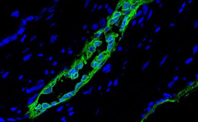 Фото - Учёные открыли новую разновидность стволовых клеток